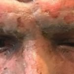 lucas viatri accidente pirotecnia peñarol radiolared twitter 2