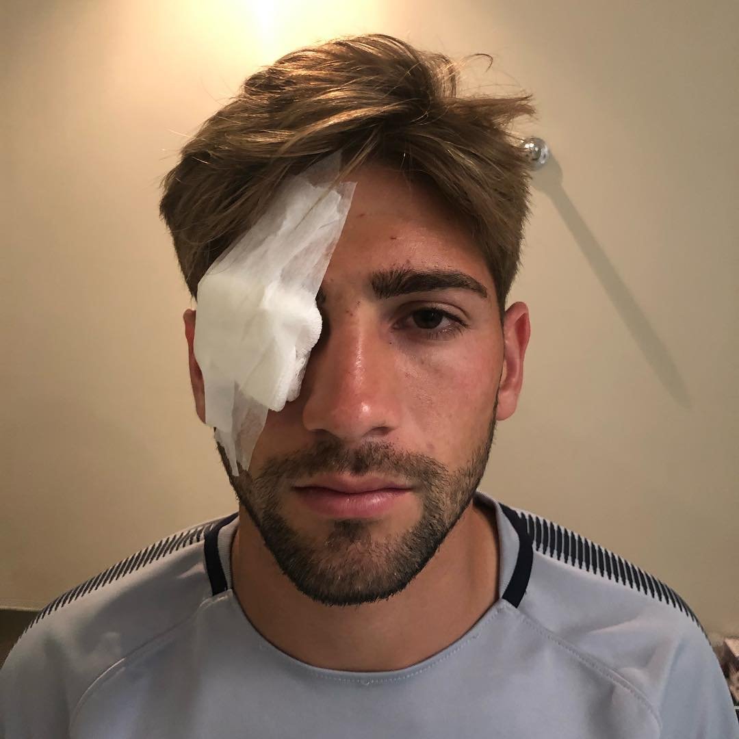 Gonzalo Lamardo- agresion previo a la final de la Copa Libertadores 24-11-18 Foto medico Boca Jorge Batista publico en Instagram